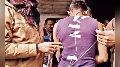 सिपाही भर्ती परीक्षा : नकलची अभ्यर्थी के कान में फंस गया ब्लूटुथ डिवाइस, करना होगा ऑपरेशन