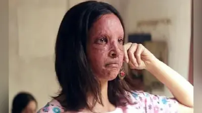सोशल मीडिया पर फिल्म “छपाक” देखकर बोले दर्शक, इस फिल्म से सारे अवार्ड जीत जायेंगी दीपिका