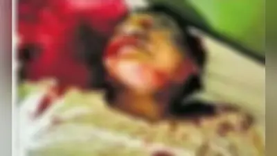 देवघर : डॉ विनोद पर घर में घुस कर हमला, कराहने की आवाज पर उठी नर्स फिर…