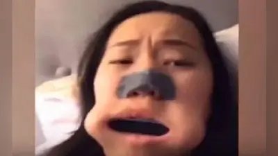 VIRAL: TikTok यूजर के मुंह में फंसा माउथ ऑर्गन, Video शेयर कर कही यह बात