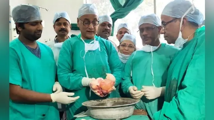 छह माह के नवजात के पेट से निकाला गया सवा किलोग्राम का भ्रूण