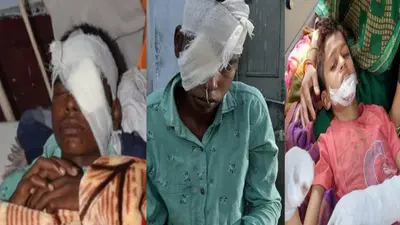 अलीगढ़ में दिवाली में जरा सी लापरवाही से आतिशबाजी में कई घायल, पटाखा जलाने को लेकर कई जगह मारपीट