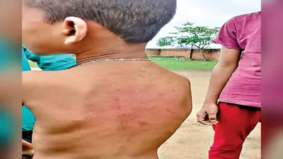 एक दिन अनुपस्थित रहने पर बच्चे की शिक्षक ने की बेरहमी से पिटाई, BEEO ने कहा होगी कार्रवाई
