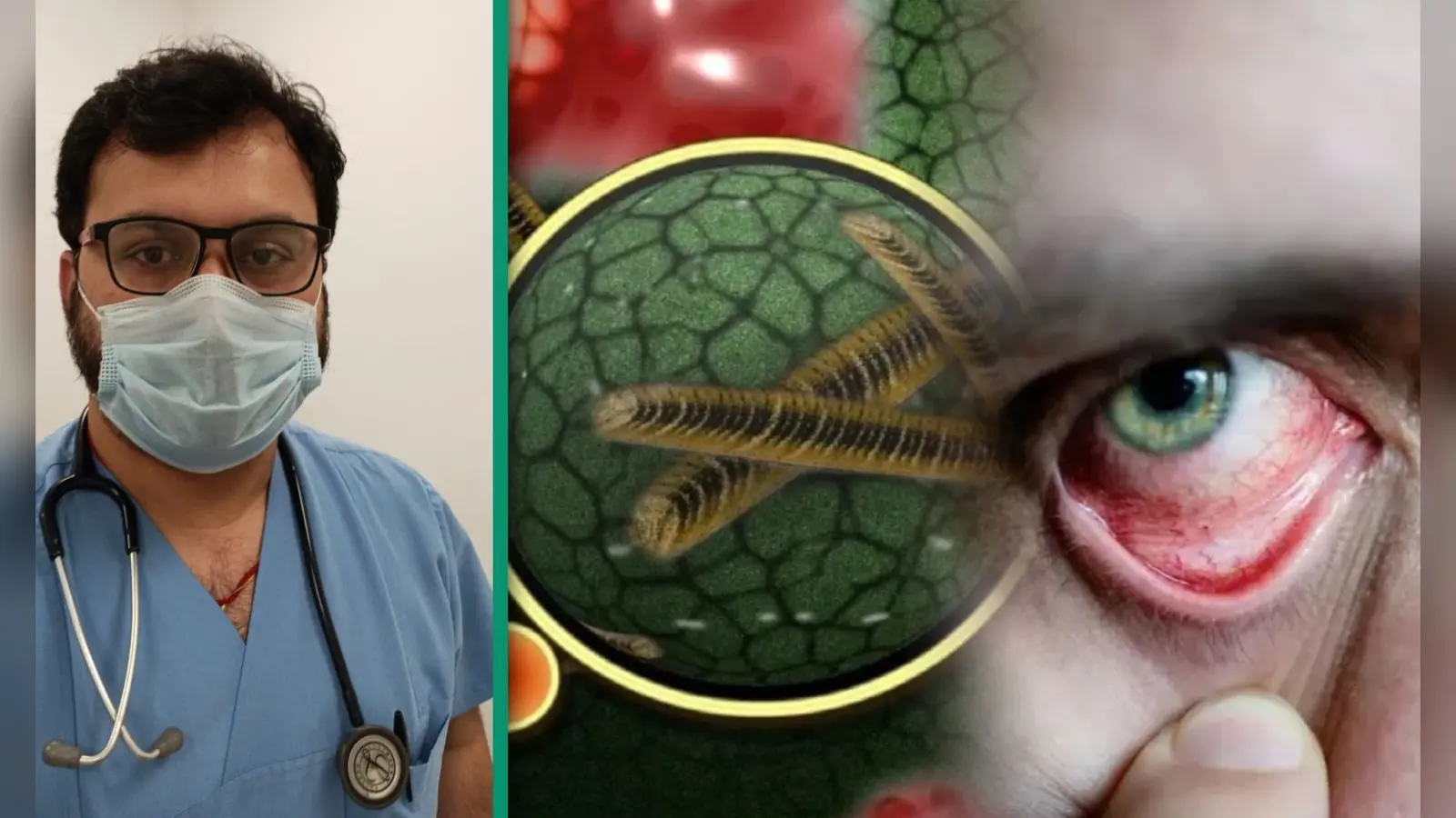 Black Fungus: क्यों इतना खतरनाक है ब्लैक फंगस, जानें इसके लक्षण व बचाव के उपाय, कैसे कोरोना मरीजों पर कर रहा अटैक, जानें सबकुछ एक्सपर्ट से