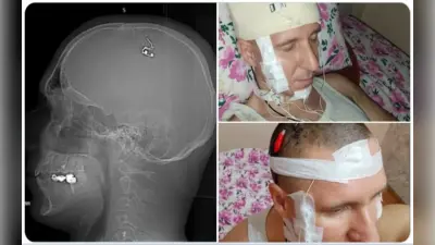 सपने को कंट्रोल करने के लिए आप ऐसा हरगिज न करें, जैसा इस रूसी शख्स ने किया; पढ़ें पूरी खबर