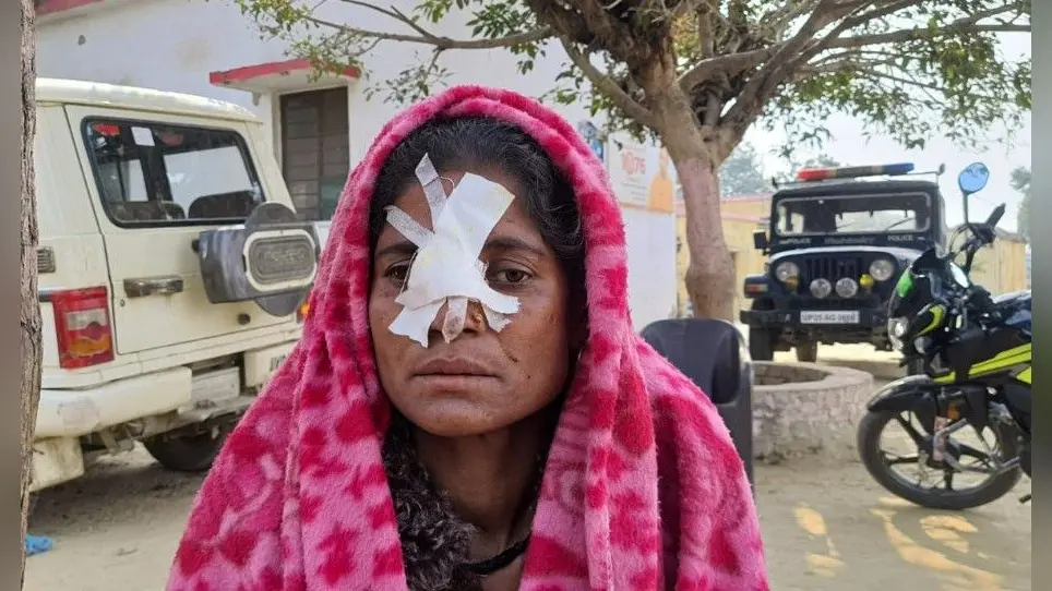 Bareilly News: पूर्व प्रधान के भाई ने चाकू से महिला की काटी नाक, मौके से हुआ फरार