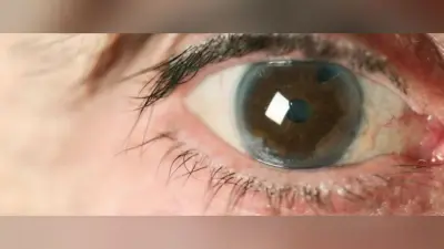 मोतियाबिंद कैसे होता है? क्या है इसके कारण और उपचार