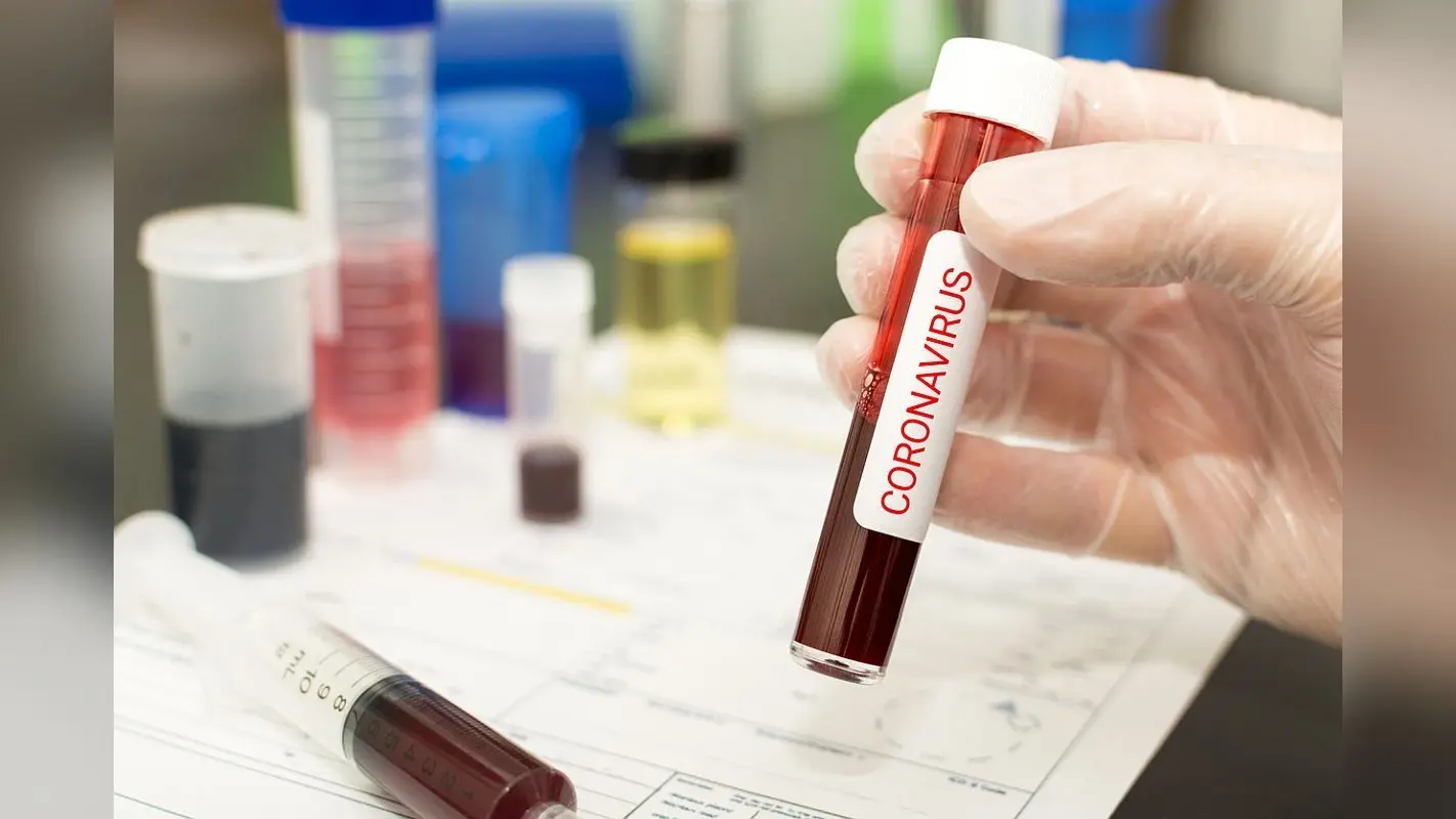 Coronavirus Pandemic: झारखंड में 14 लोगों को हुआ कोविड-19, एक की हुई मौत, एक गंभीर