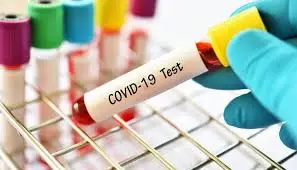 Coronavirus in Bihar : बिहार में 1.35 लाख सैंपलों की जांच में मिले 6286 नये केस, संक्रमण दर घट कर हुई 4.65 प्रतिशत