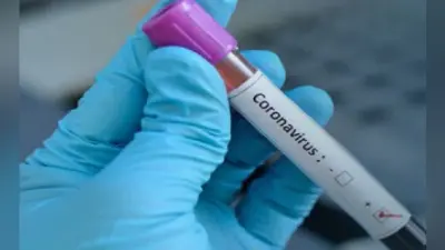Covid-19: आगरा में फिर डराने लगा कोरोना, 24 घंटे में 15 नए केस, पूर्व राज्यमंत्री की रिपोर्ट भी पॉजिटिव