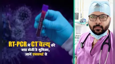 RT-PCR Test में कितना होना चाहिए CT Value, कम वैल्यू वाले क्यों ज्यादा फैलाते है संक्रमण, Lab में कैसे पता चलता है वायरस के बारे में, जानें एक्सपर्ट से