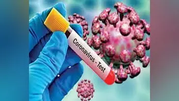 Coronavirus Update: लखनऊ में थम नहीं रहा कोरोना का ग्राफ, 119 नए मामलों के साथ 875 एक्टिव केस, ओपीडी में भीड़