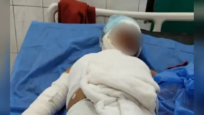 बिहार: मुजफ्फरपुर के सरैया में दोस्त ने पेट्रोल छिड़क कर युवक को जिंदा जलाया, 60 प्रतिशत झुलसा