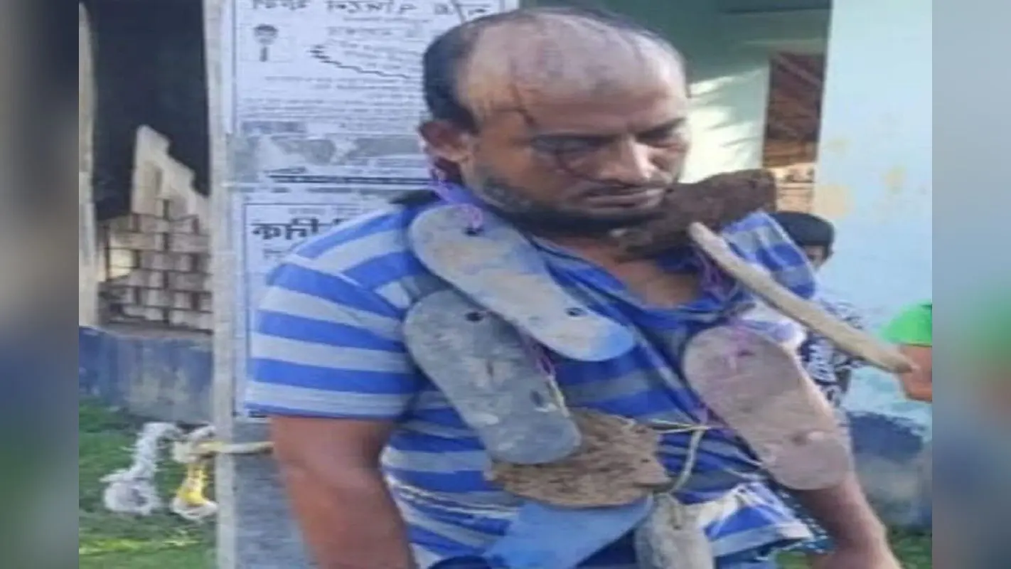 West Bengal News: महिला से अवैध संबंध को लेकर सालिसी सभा ने सुनाया फरमान, सिर मुंडकर पहनायी जूते की माला