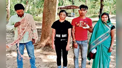 दुमका एसिड अटैक मामला : पीड़ित परिवार ने एसपी से लगायी न्याय की गुहार, छप्पर छारने के दौरान हुआ था विवाद