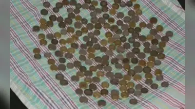 सर्जरी के दौरान पेट से निकाले गए 187 सिक्के, डॉक्टर भी हैरान, जानें क्या है मामला