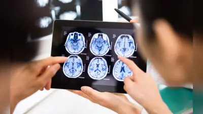 Stroke: स्ट्रोक क्या है और कैसे आता है? जानें इसके लक्ष्ण और बचाव