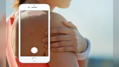 Google Lens से पता लगेगी त्वचा से जुड़ी बीमारी, ये रहा तरीका