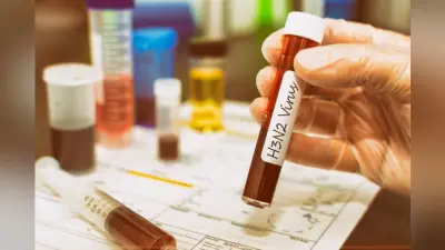 बरेली में H3N2 वायरस का बढ़ा खतरा, एक युवक और बच्ची में हुई पुष्टि, जानें क्या है लक्षण, बचाव