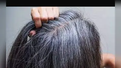 Hair Care Tips: असमय सफेद बालों की समस्या से हैं परेशान? आजमाएं ये आसान घरेलू नुस्खे