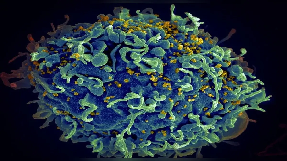 क्या है Cord Blood Treatment, जानिए कैसे ठीक हुआ मिश्रित नस्ल की अमेरिकी महिला का HIV