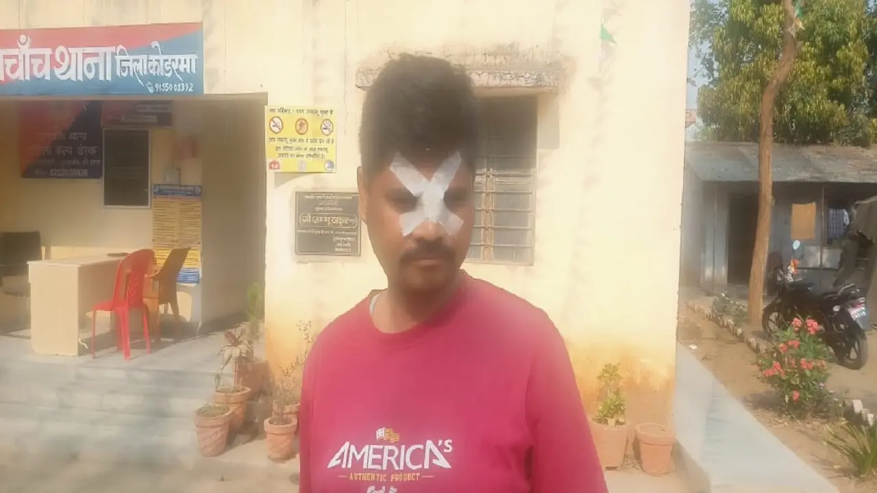 Holi 2022: होली को लेकर दो गुटों में हुई झड़प, शांत कराने गई पुलिस टीम पर पत्थरबाजी, कई पुलिसकर्मी चोटिल