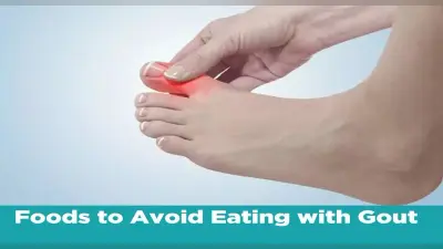 Home Remedies for Uric Acid: सर्दियों में बढ़ जाती हैं यूरिक एसिड की समस्या, इन तरीकों से करें कंट्रोल
