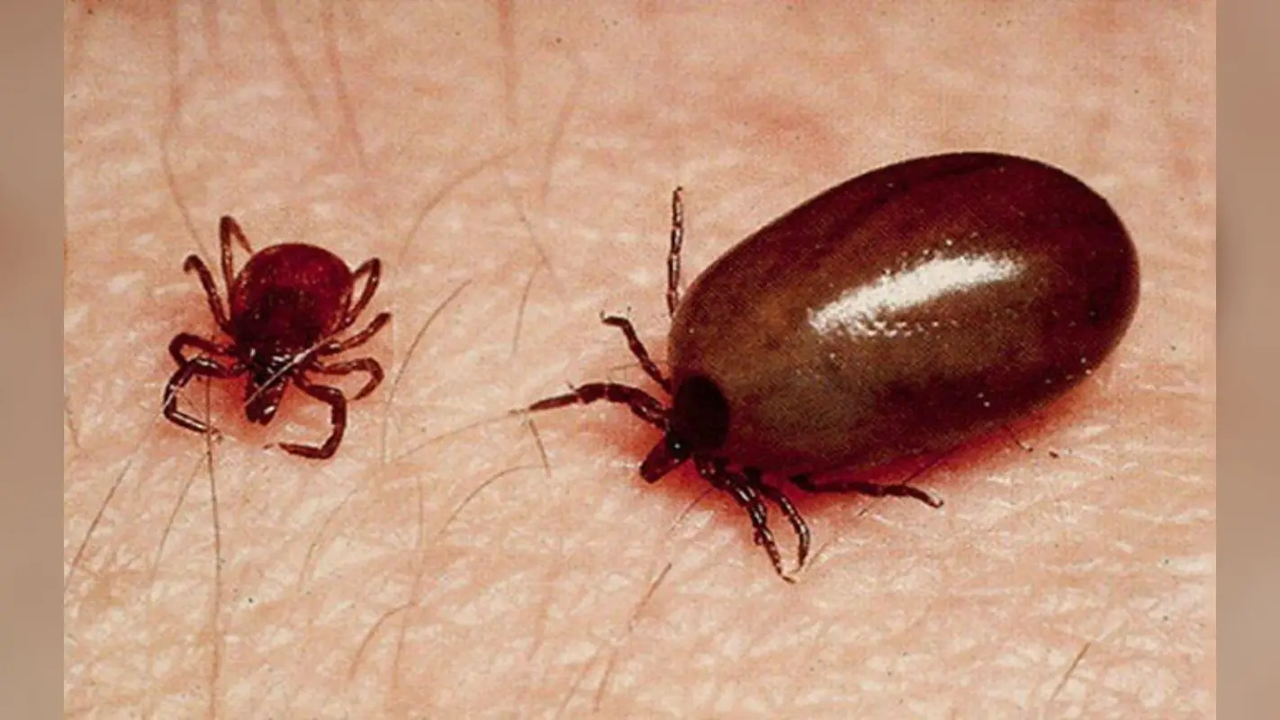 Health: क्या है ‘Scrub Typhus’? कैसे फैलता है ये और क्या है इसका इलाज, जानें यहां सबकुछ
