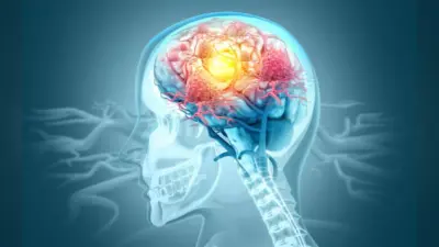 Research Alzheimer’s Treatment : स्टेम सेल उपचार ने अल्जाइमर के लक्षणों को घटाने की जगाई उम्मीद