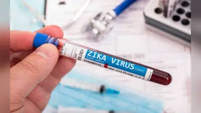 Health Care : Zika virus का क्या है लक्षण, जानें कारण और बचाव के उपाय