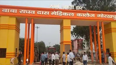 बीआरडी मेडिकल कॉलेज में नई तकनीक से शुरू हुई एंजियोप्लास्टी, जानें खासियत और मरीजों को कैसे मिलेगा लाभ