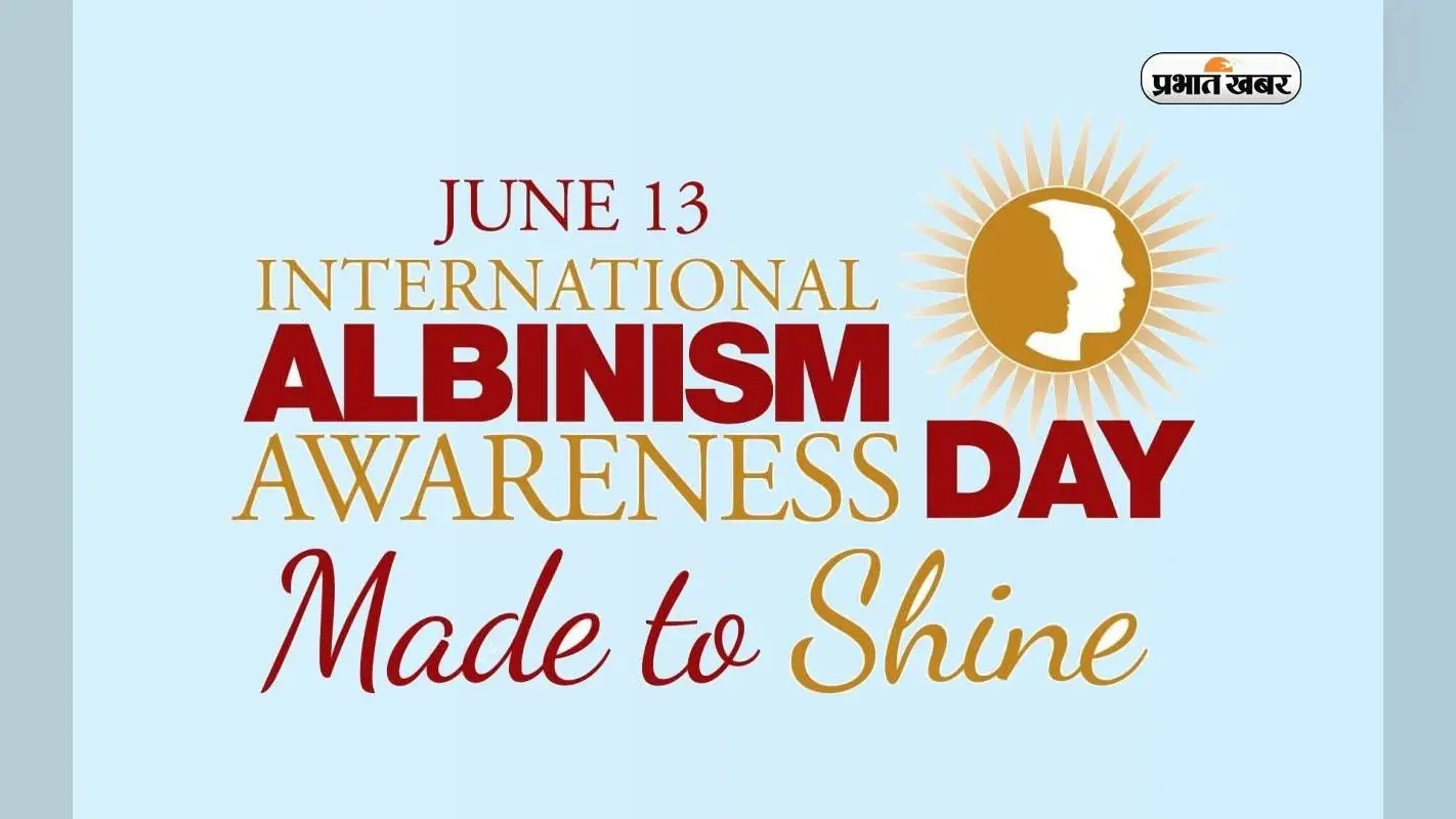 International Albinism Awareness Day 2023: अंतरराष्ट्रीय रंजकहीनता जागरूकता दिवस आज, जानें इसके बारे में
