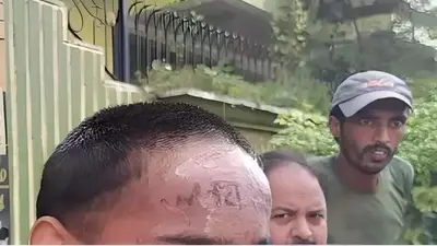 बरेली में शर्मनाक हरकत, मंदबुद्धि युवक के माथे पर ममेरे भाई ने गोदा ‘जय भोलेनाथ’, जानें फिर क्या हुआ…
