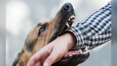 What To Do If Dog Bite: कुत्ते के काटने पर क्या करें, कब लगवाना चाहिए इंजेक्शन? जानें जरूरी बातें