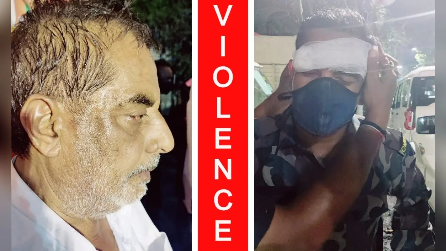 कोलकाता में BJP के प्रचार अभियान में चली गोली, हंगामा, उम्मीदवार शिवाजी सिंह राय और CISF का जवान घायल