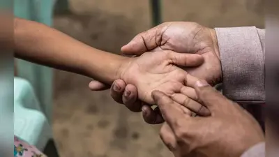 झारखंड में कुष्ठ रोगियों की पहचान कर रही सरकार, छुपाएं नहीं, पूरी तरह ठीक हो सकती है यह बीमारी