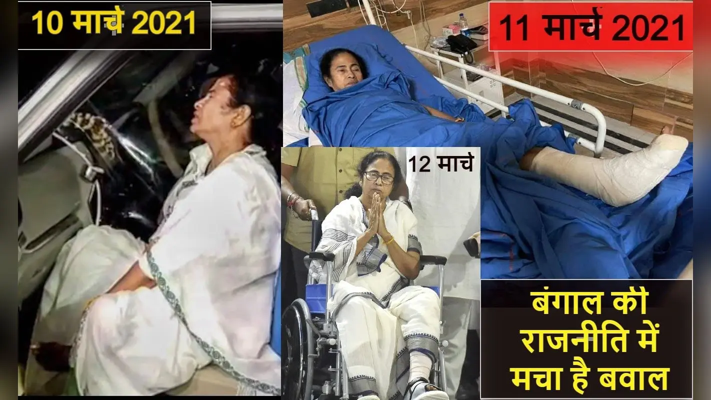 24 घंटे में ही प्लास्टर से क्रेप बैंडेज! हमें तो मालूम ही नहीं था कि हड्डी के इलाज में बंगाल इतना आगे निकल गया है