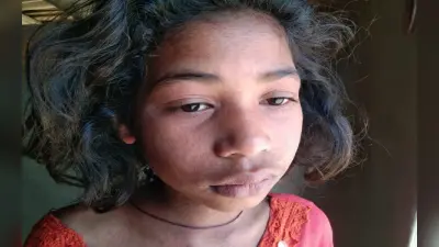 झारखंड: मीजल्स से तेजी से पीड़ित हो रहे बच्चे-बूढ़े, सहमे हैं ग्रामीण