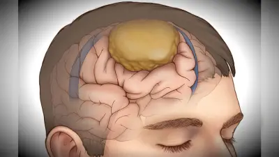 ब्रेन ट्यूमर दिवस: मोबाइल टावर से निकलने वाले रेडिएशन या प्रदूषण भी हो सकता इस बीमारी का कारण, जानें इसके लक्षण व उपचार