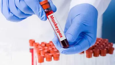 Hyderabad: सीवेज सर्विलांस सिस्टम से मंकीपॉक्स और डेंगू के मामलों को ट्रैक में मिलेगी मदद, पढ़ें रिपोर्ट