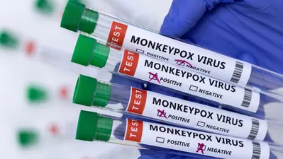 Mpox News: संक्रमण बीमारी से लड़ने के लिए भारत ने कसी कमर, दिल्ली AIIMS ने जारी किया Protocol
