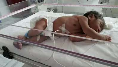 बिन ब्याही मां ने नवजात को नाली में फेंका, गोद लेने आये आ गये 15 लोग