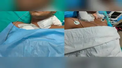 मिसाल : ब्रेन डेड महिला के अंगों ने सेना के दो जवान समेत पांच लोगों की बचाई जान