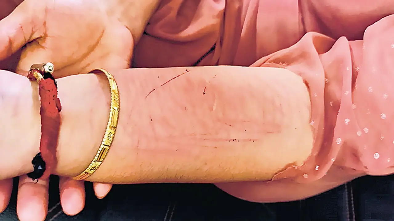 पटना में युवती के शरीर पर ब्लेड से काटकर लिखा’ I HATE U’, बेहोशी टूटी तो ट्रक में थे दो लड़के, और फिर…