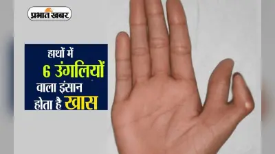 6 उंगलियों वाले लोगों की होती है कुछ ऐसी पर्सनालिटी, जानिए और क्या है इनकी खासियत