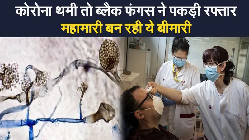 Black Fungus India Update: कोरोना के बाद ब्लैक फंगस ने पकड़ी रफ्तार, राज्यों ने अलर्ट किया जारी