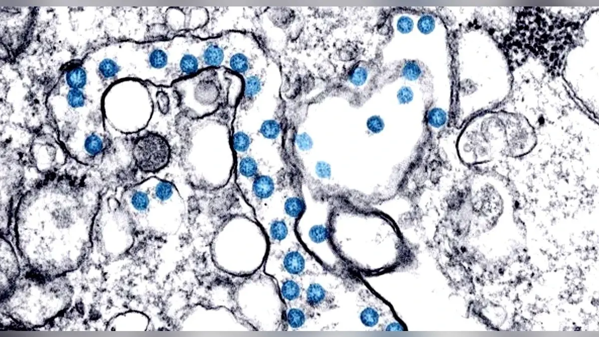 Coronavirus Omicron variant: ओमिक्रोन के बीए.2.75 उपस्वरूप का भारत में प्रसार सीमित- रिपोर्ट