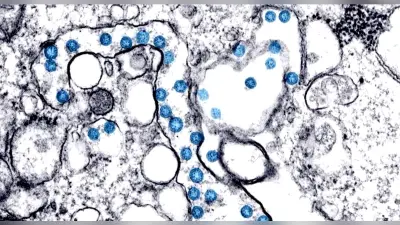 Coronavirus Omicron variant: ओमिक्रोन के बीए.2.75 उपस्वरूप का भारत में प्रसार सीमित- रिपोर्ट