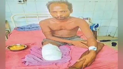 दलालों के चक्कर में युवक का कटा पैर, JLNMCH से आयुष्मान अस्पताल आना पड़ा महंगा