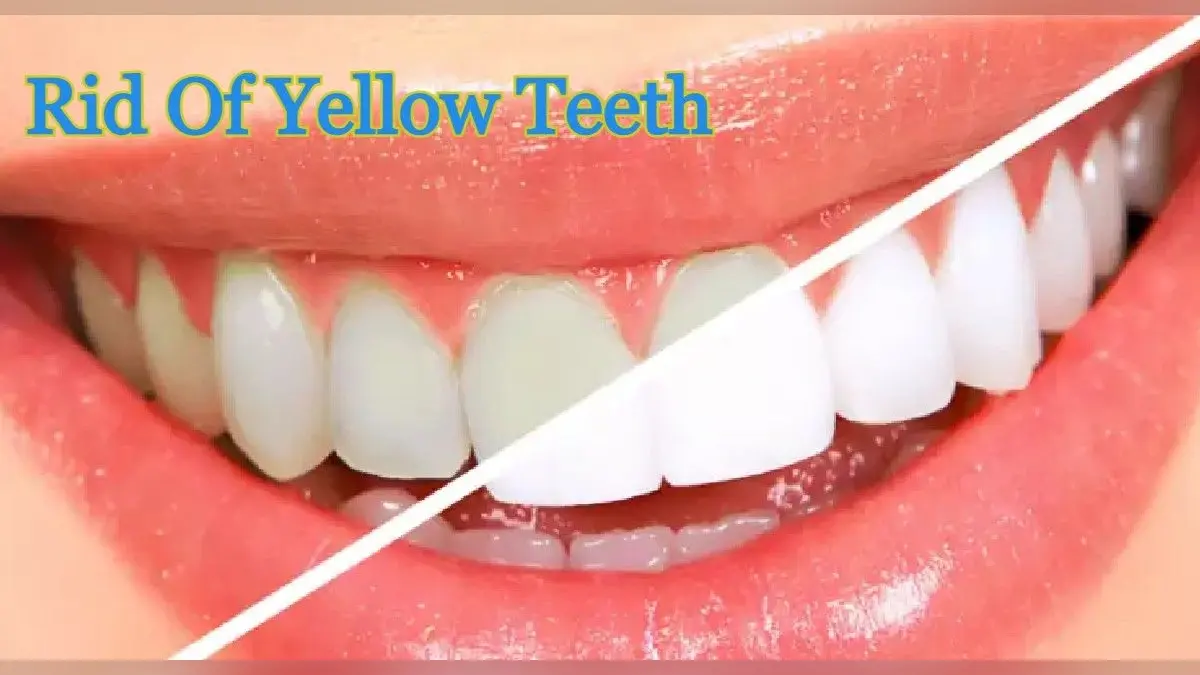 Rid Of Yellow Teeth: दांतों के नैचुरल कलर को खराब करते हैं ये फूड्स, पीलेपन के लिए हैं जिम्मेदार, जानें